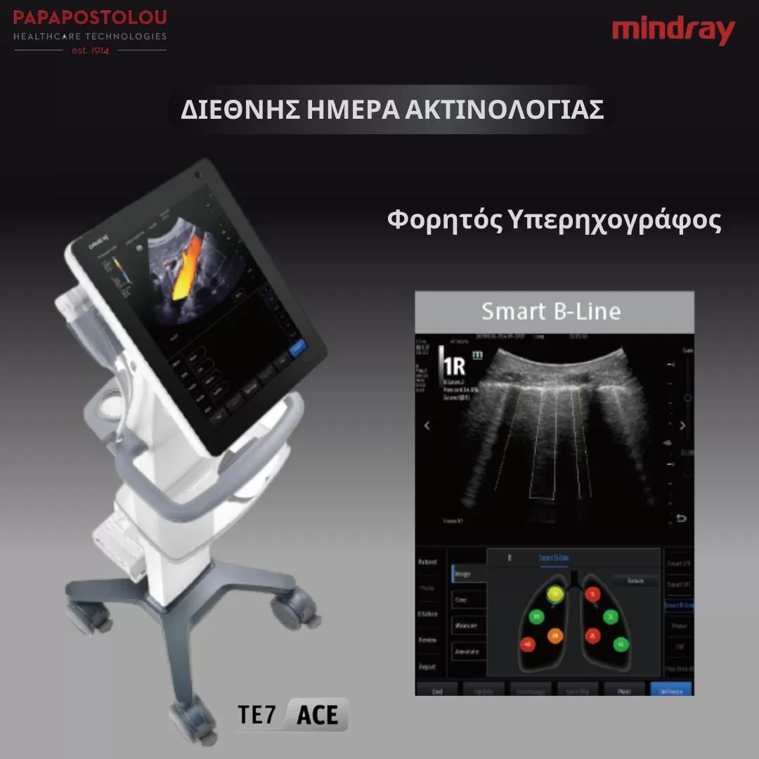 te7 ace υπερηχογράφος