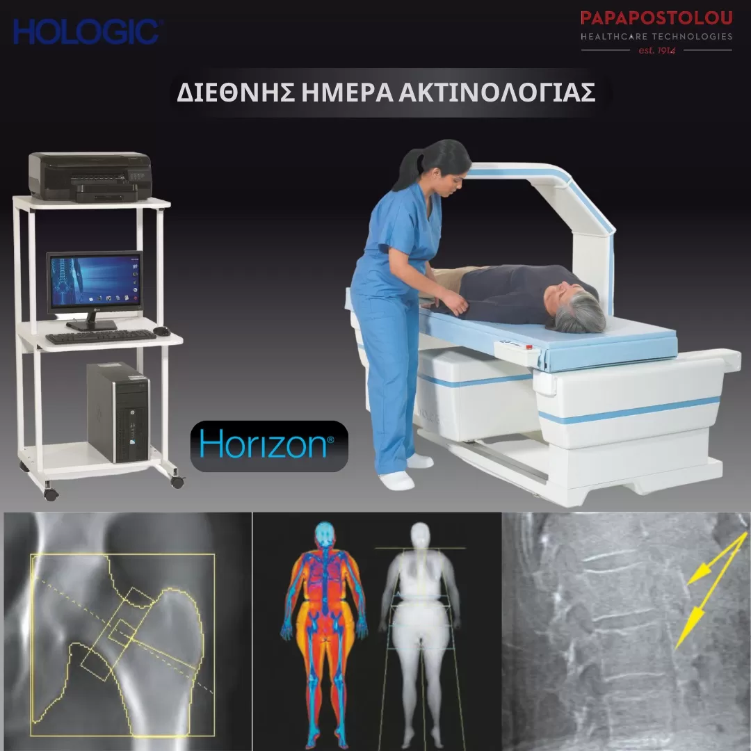 4_ΗΟRΙΖΟΝ σύστημα μέτρησης οστικής πυκνότητας