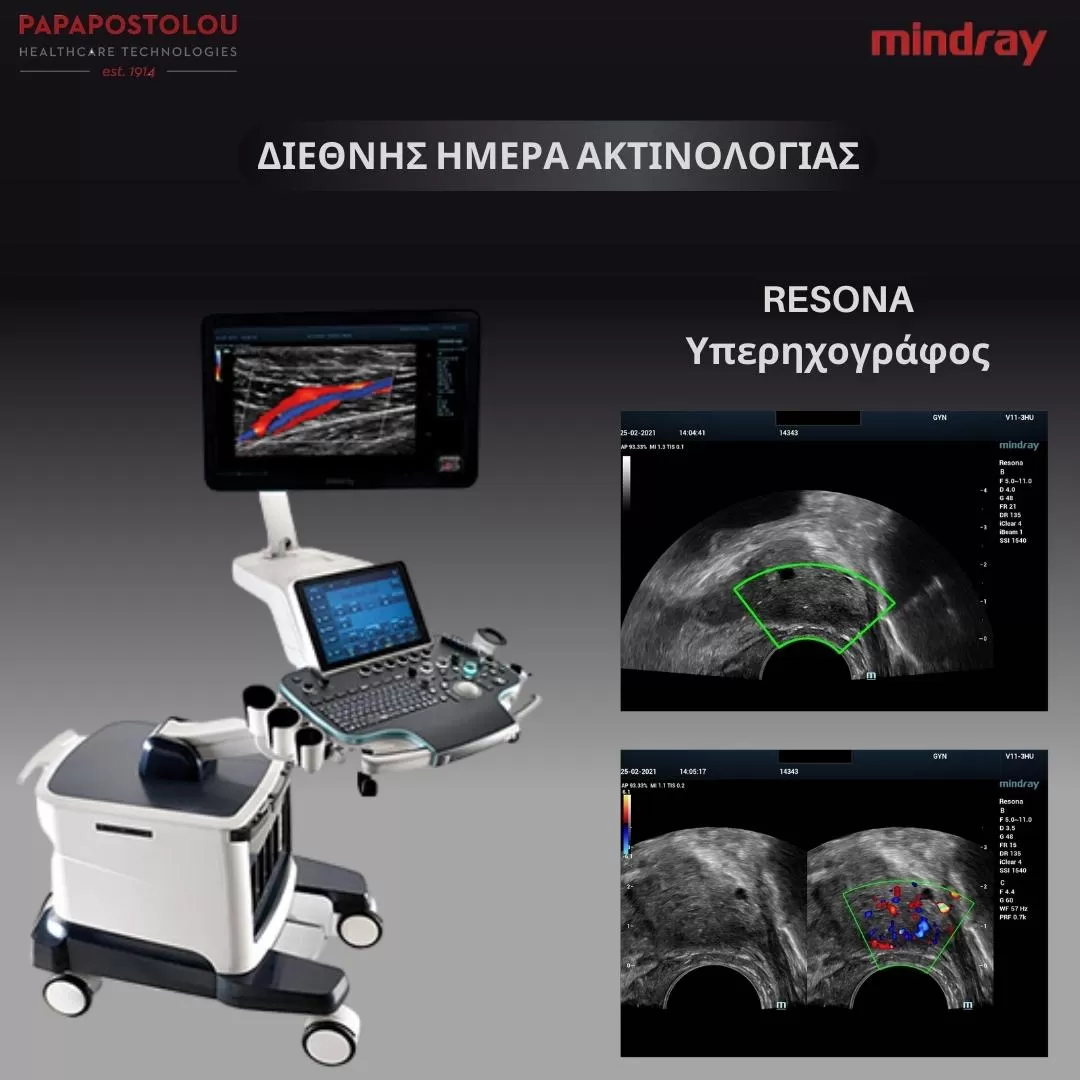 resona συστήματα υπερήχων