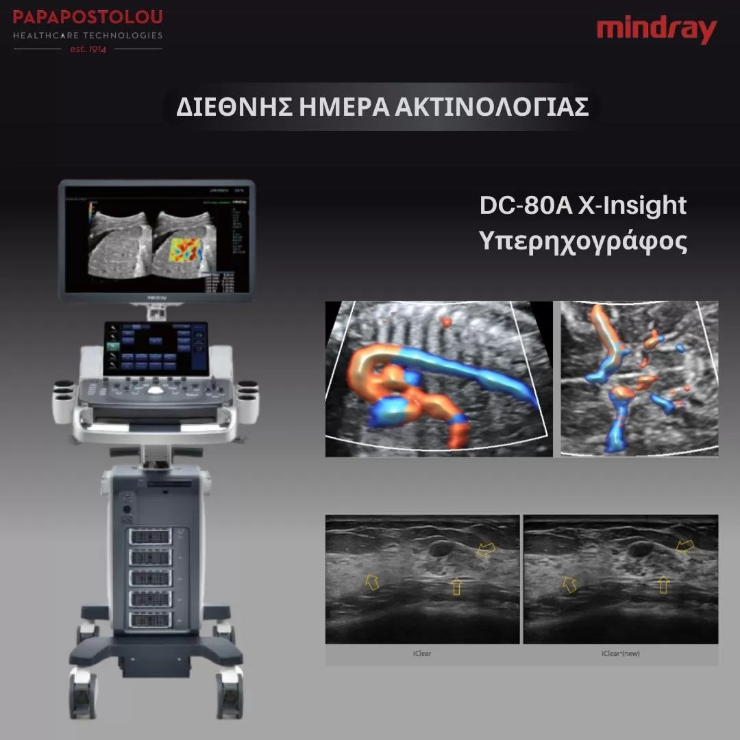 dc-80a X INSIGHT ultrasound