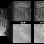 AeroDR 3, Wireless Digital Radiography System