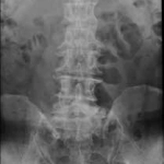 AeroDR 3, Wireless Digital Radiography System