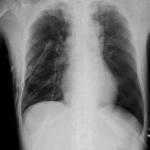 AeroDR 3, Wireless Digital Radiography System