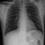 AeroDR 3, Wireless Digital Radiography System