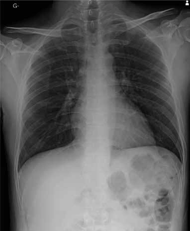 AeroDR 3, Wireless Digital Radiography System