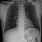 AeroDR 3, Wireless Digital Radiography System