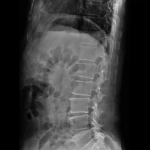 AeroDR 3, Wireless Digital Radiography System