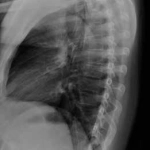 AeroDR 3, Wireless Digital Radiography System