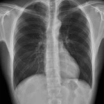 AeroDR 3, Wireless Digital Radiography System