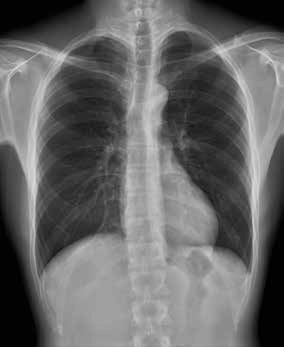 AeroDR 3, Wireless Digital Radiography System