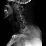 AeroDR 3, Wireless Digital Radiography System