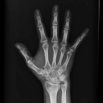 AeroDR 3, Wireless Digital Radiography System