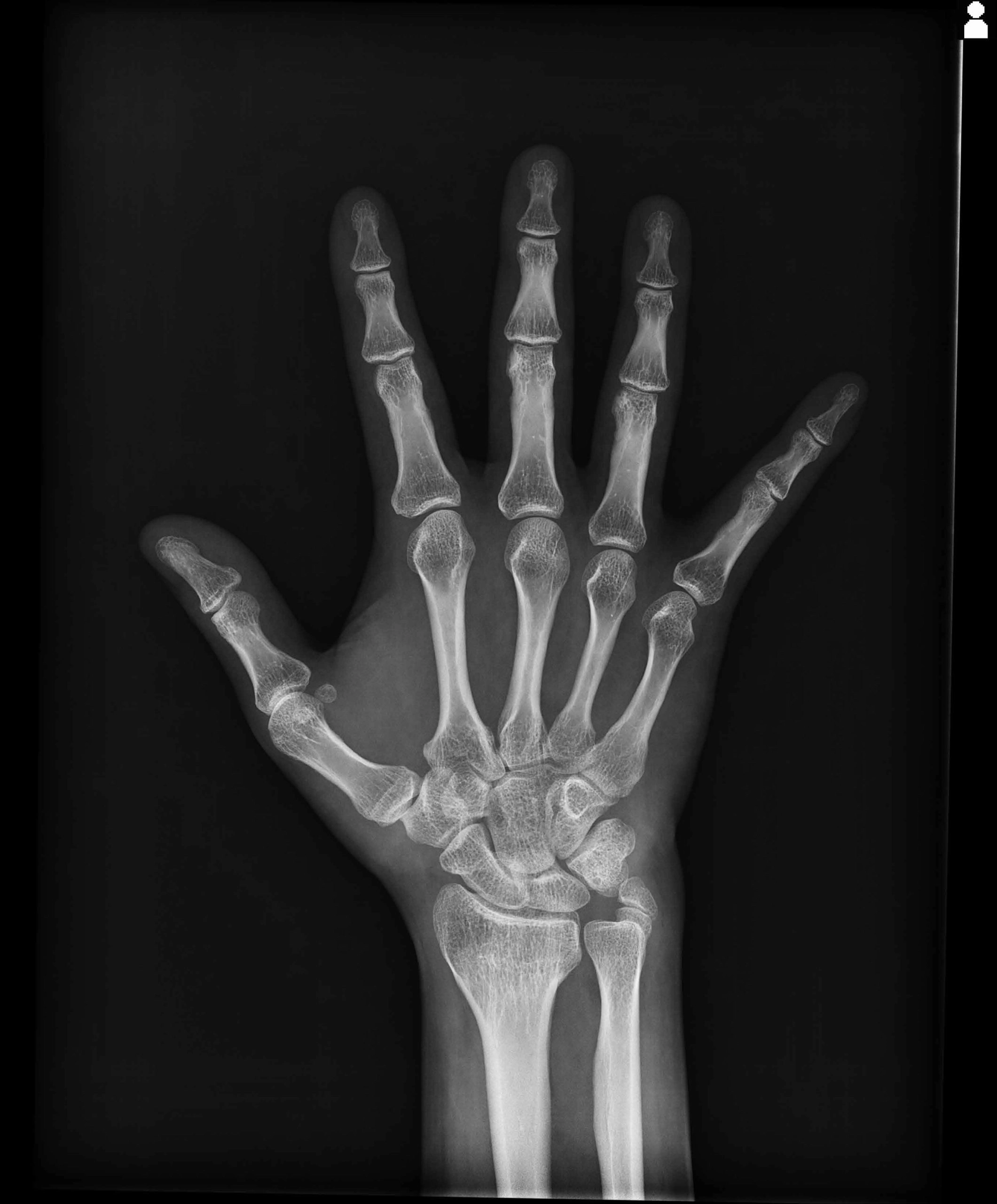 AeroDR 3, Wireless Digital Radiography System