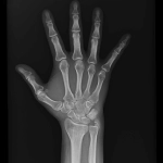 AeroDR 3, Wireless Digital Radiography System