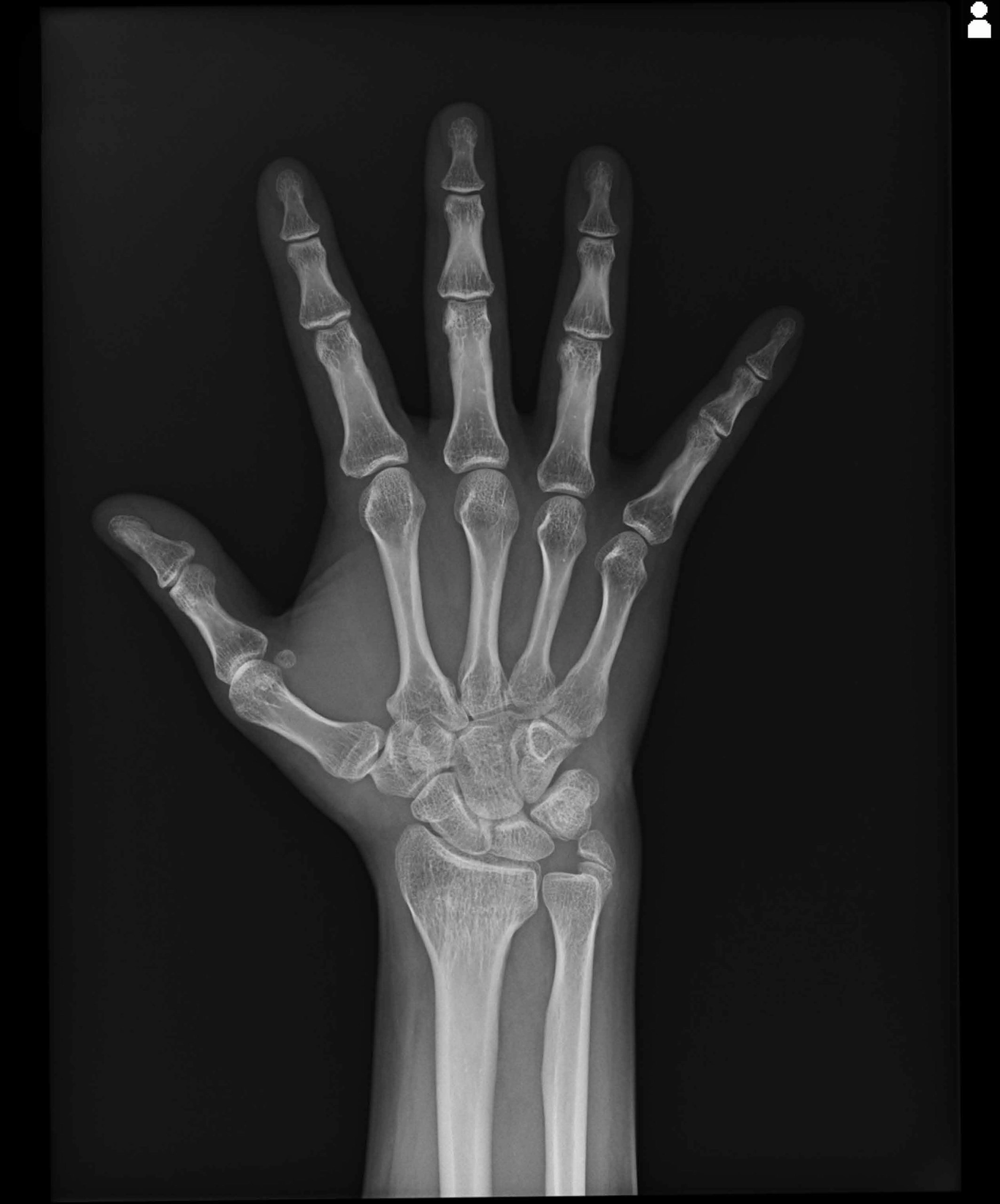 AeroDR 3, Wireless Digital Radiography System