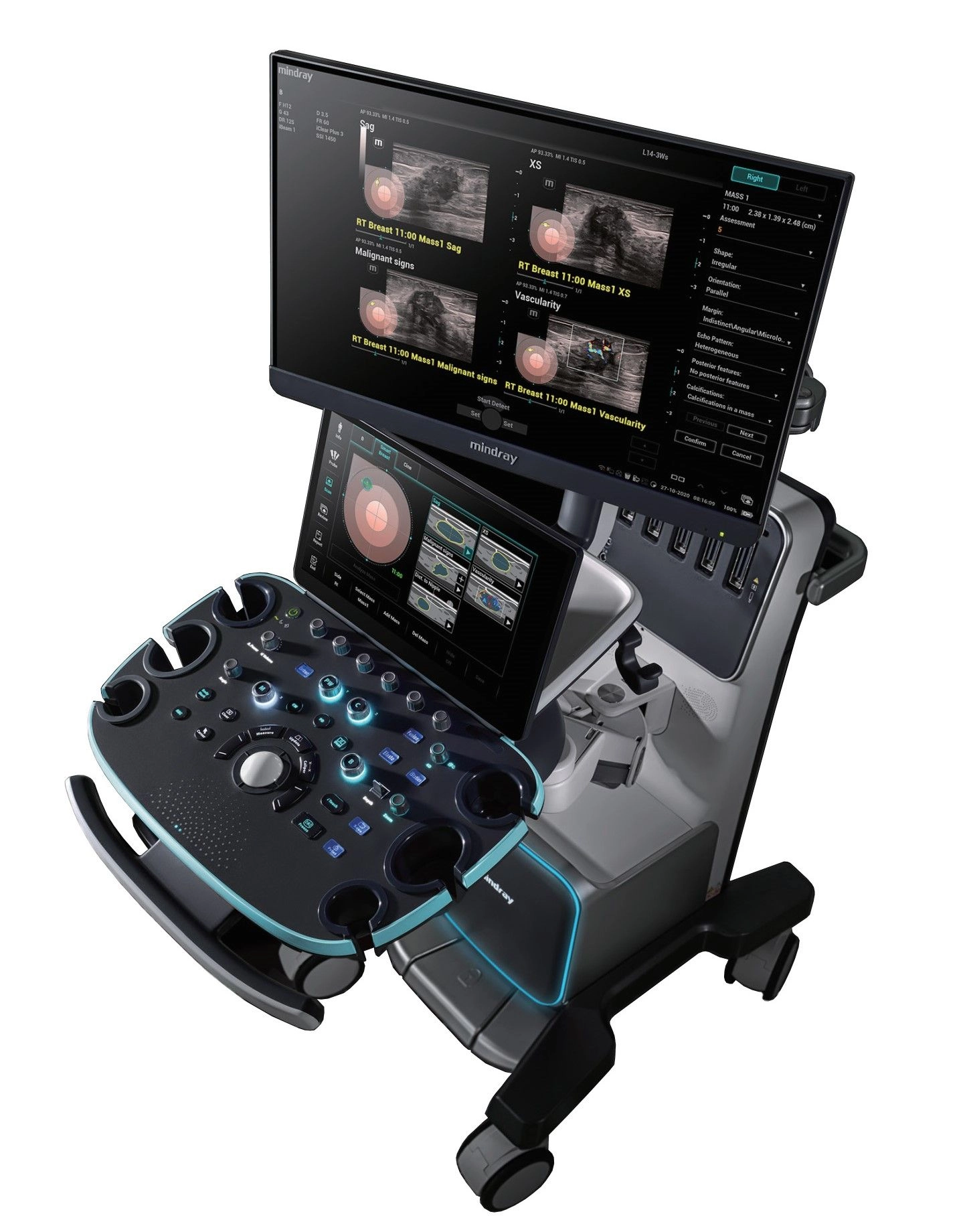 Τροχήλατος Ακτινολογικός Υπέρηχος Mindray Resona I9