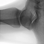 Φορητό Ακτινοσκοπικό Μηχάνημα C-arm, ORTHOSCAN MOBILE DI