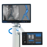 Συστήματα EndoNaut & EndoSize