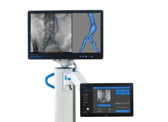 Συστήματα EndoNaut & EndoSize