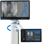 Συστήματα EndoNaut & EndoSize