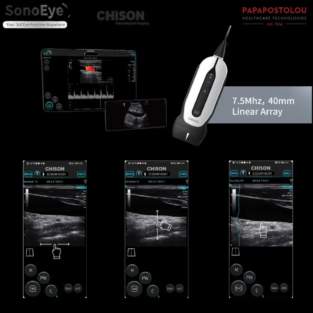 συνεδριο καρδιολογιας