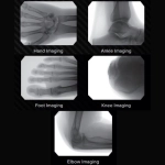 Φορητό Ακτινοσκοπικό Μηχάνημα C-arm, ORTHOSCAN MOBILE DI