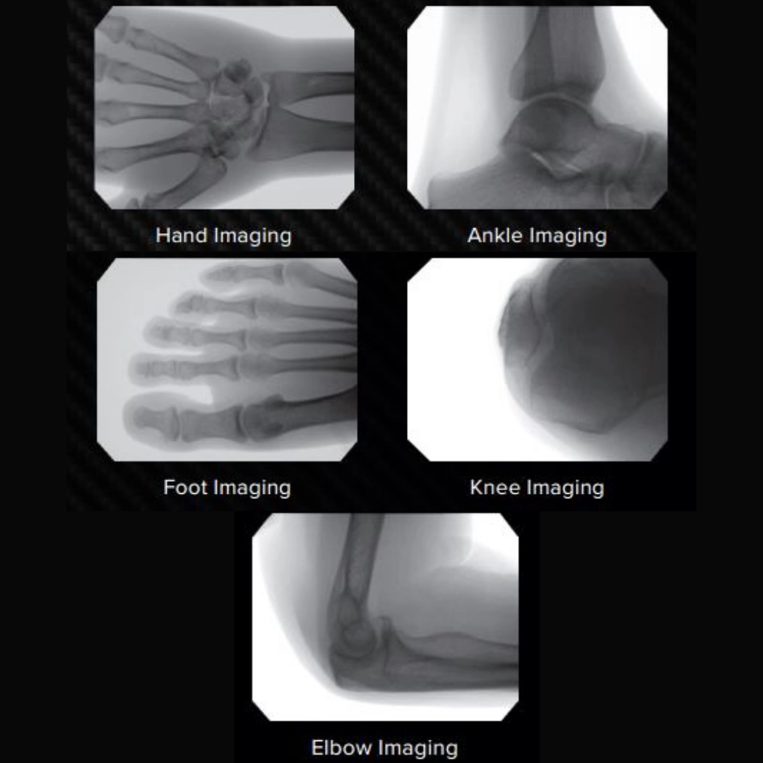 Φορητό Ακτινοσκοπικό Μηχάνημα C-arm, ORTHOSCAN MOBILE DI