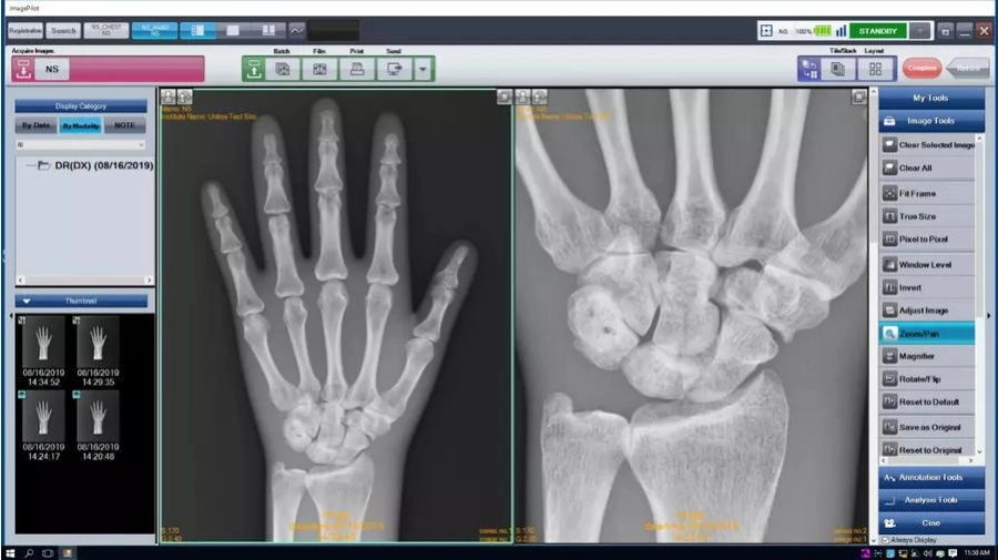 AERODR NS™, Φορητός Ψηφιακός Ανιχνευτής