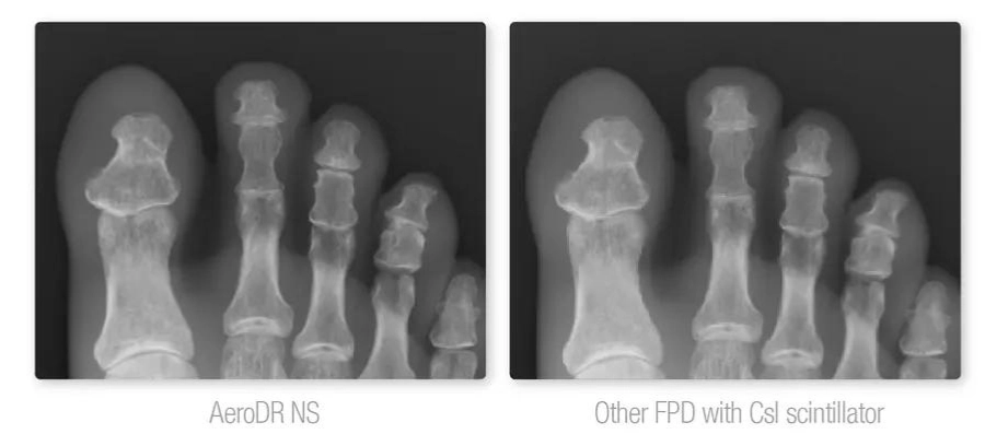 AERODR NS™, Φορητός Ψηφιακός Ανιχνευτής