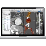 Συστήματα EndoNaut & EndoSize