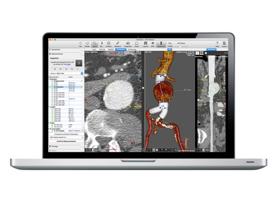 Συστήματα EndoNaut & EndoSize