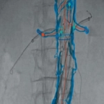 Συστήματα EndoNaut & EndoSize