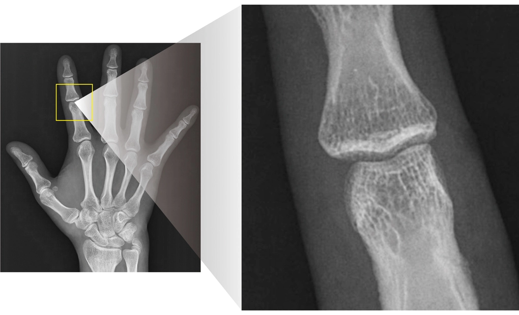 AeroDR 3 HD2, Wireless Digital Radiography System