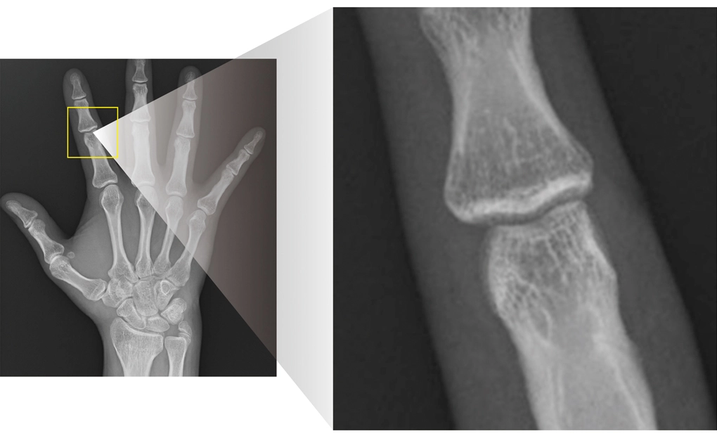 AeroDR 3 HD2, Wireless Digital Radiography System