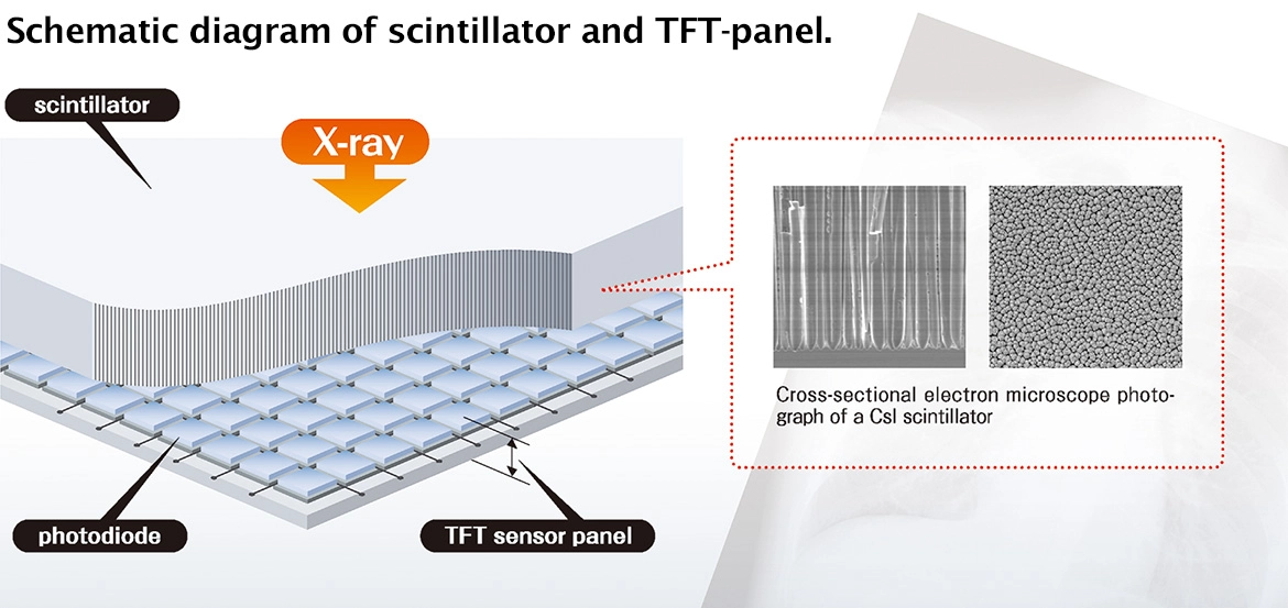 AeroDR2 1417S, Wireless Digital Radiography System