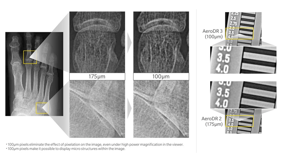 AeroDR 3 HD2, Wireless Digital Radiography System