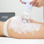 Zionic, Πρωτοποριακή τεχνολογία κατά της κυτταρίτιδας