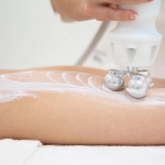 Zionic, Πρωτοποριακή τεχνολογία κατά της κυτταρίτιδας