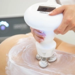 Zionic, Πρωτοποριακή τεχνολογία κατά της κυτταρίτιδας