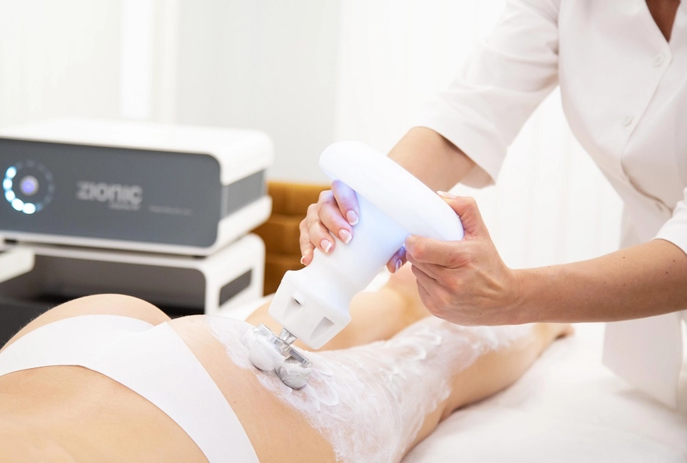 Zionic, Πρωτοποριακή τεχνολογία κατά της κυτταρίτιδας