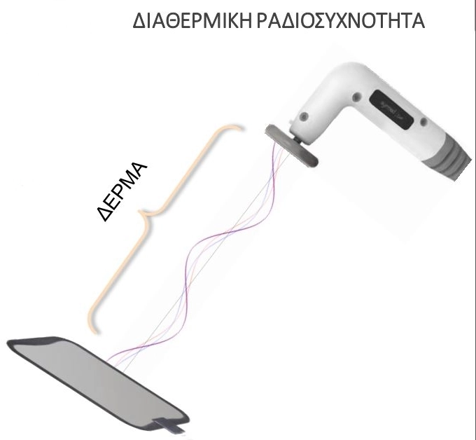 SYMMED Elite, προηγμένη, καινοτόμα & αποτελεσματική τεχνολογία ομορφιάς