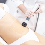 VMAT PRO, τεχνολογία κρουστικών κυμάτων