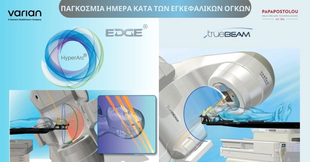 Στερεοτακτική Ακτινοχειρουργική Hyperarc – η πλέον ολοκληρωμένη λύση θεραπείας Εγκεφαλικών Όγκων