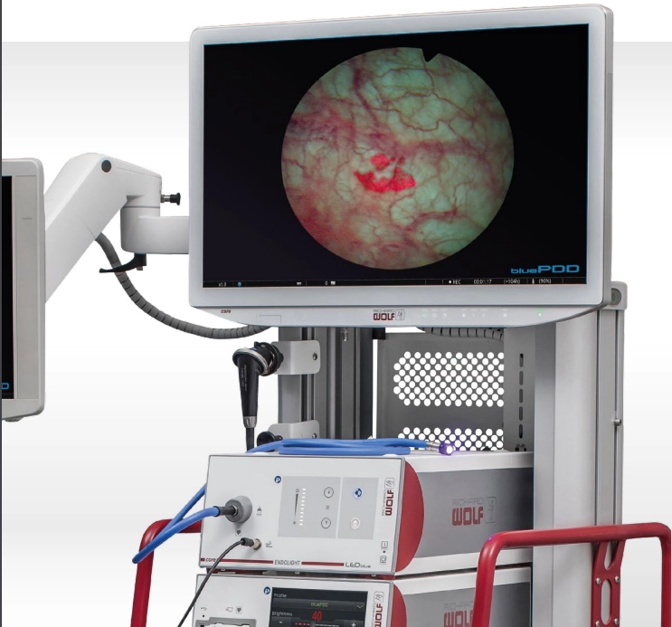 Σύστημα Φωτοδυναμικής Διάγνωσης (PDD), System Blue