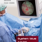 Σύστημα Φωτοδυναμικής Διάγνωσης (PDD), System Blue