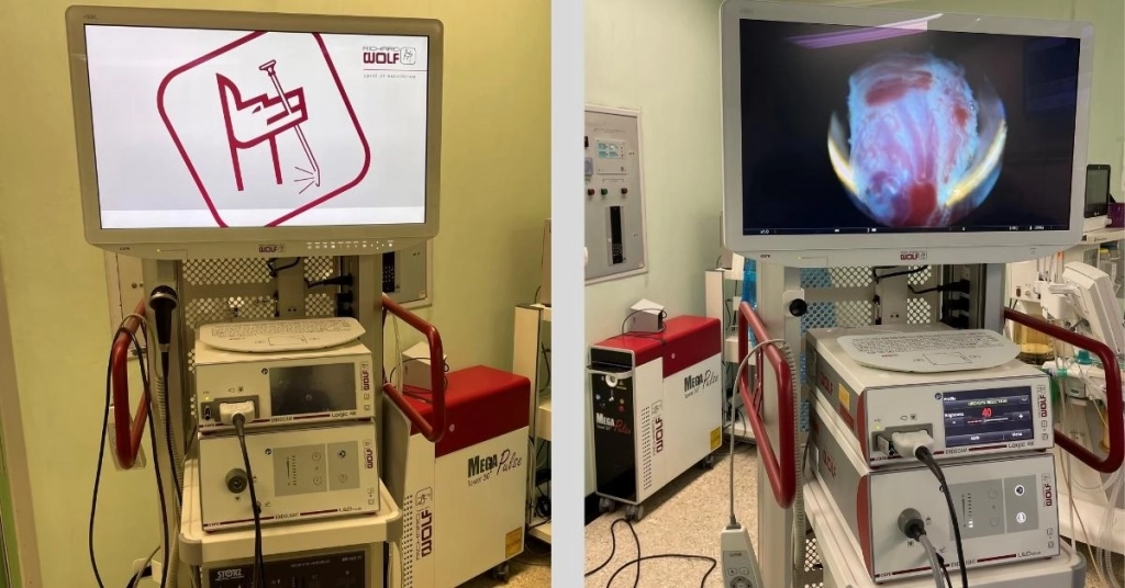 Εγκατάσταση Ουρολογικού Πύργου στο ΓΝ Ιωαννίνων Χατζηκώστα