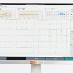Σύστημα για την διενέργεια δοκιμασίας κόπωσης και ΗΚΓφημα ηρεμίας, CS-104