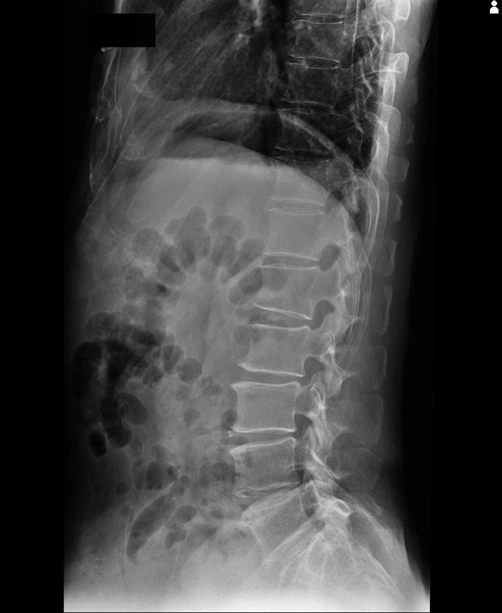 AeroDR 3 1417HL, Wireless Digital Radiography System