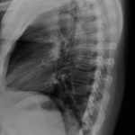 AeroDR 3 1417HL, Wireless Digital Radiography System