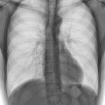 AeroDR 1417 HD3 (G5), Wireless Digital Radiography System